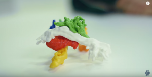 Impression 3D & Médical - modélisation tumeur